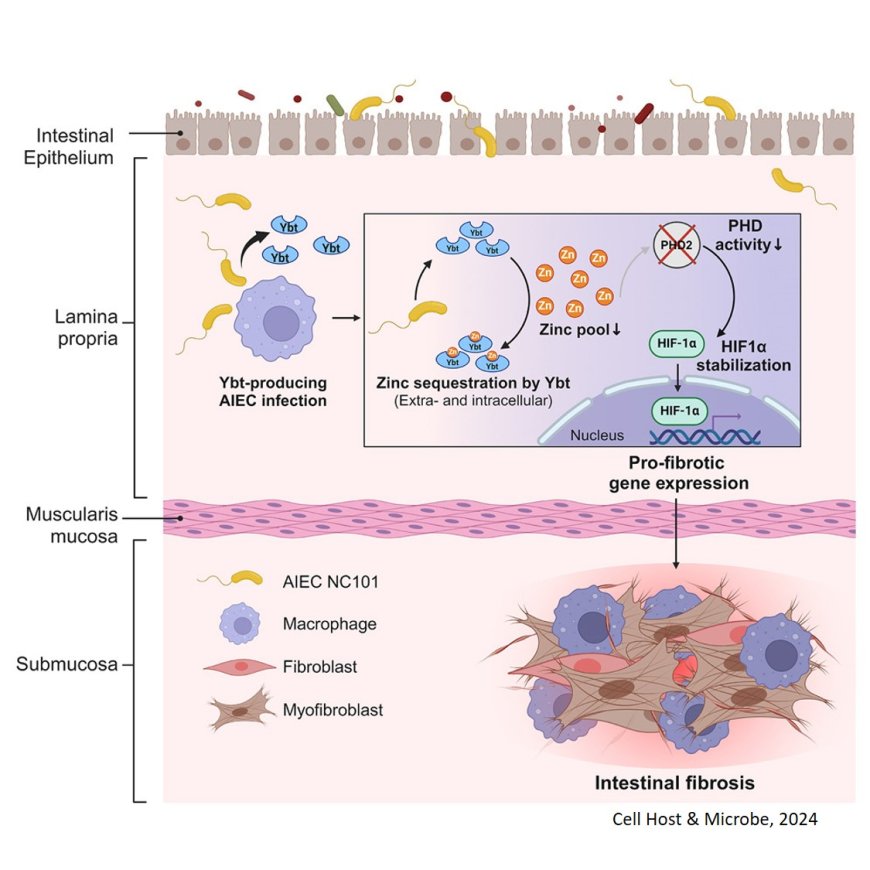 How intestinal E. coli promotes profibrotic macrophages in Crohn’s disease