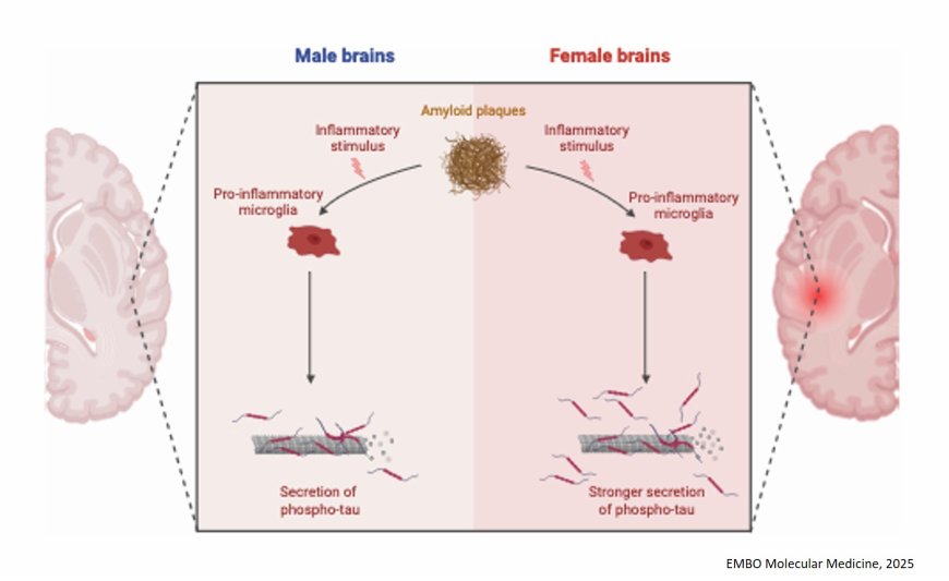 Female sex is linked to a stronger association between sTREM2 and CSF p-tau in Alzheimer’s disease