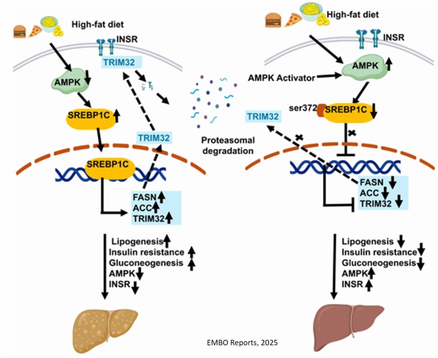 TRIM32 regulates insulin sensitivity by controlling insulin receptor degradation in the liver