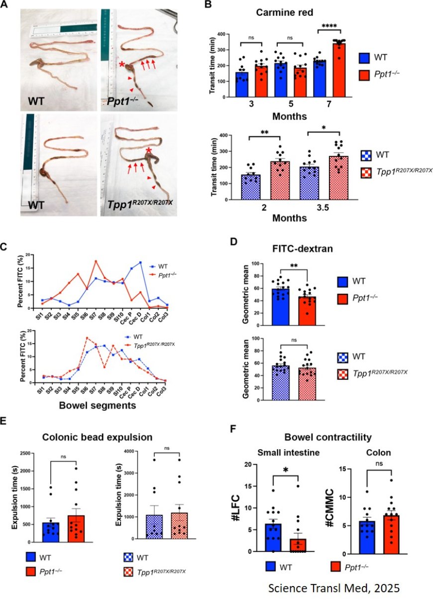 Gene therapy for childhood Batten disease slows symptoms, extend lifespan