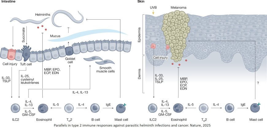 Type 2 immunity in cancer