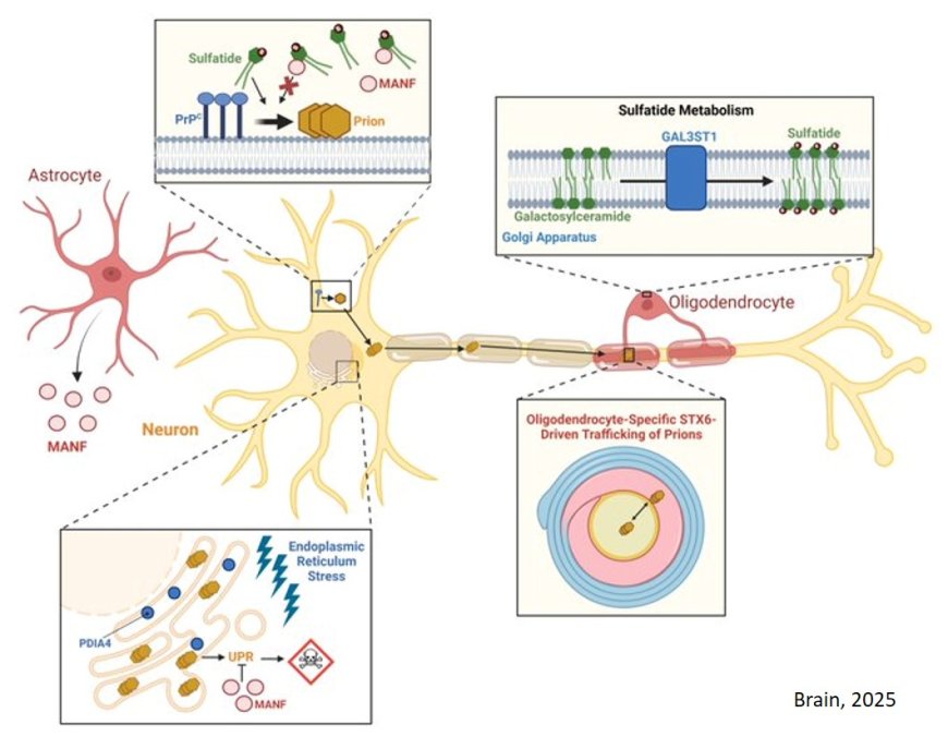 Analysis of CreutzfeldtJakob disease risk genes