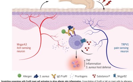 How scratching promotes allergic inflammation