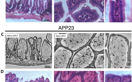 The gut-brain connection in Alzheimer’s unveiled with X-rays