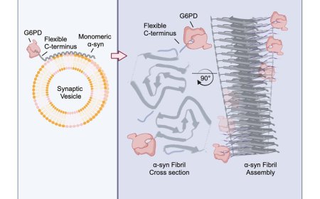G6PD deficiency triggers dopamine loss and the initiation of Parkinson’s disease pathogenesis