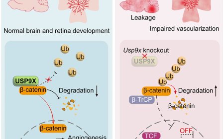 Deubiquitinase in CNS vascular formation and barrier maintenance
