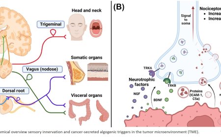 Sensory neurotransmission and pain in solid tumor progression