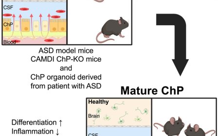 Immature choroid plexus in autism spectrum disorder