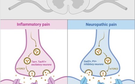 mTORC2 in inflammatory and neuropathic pain