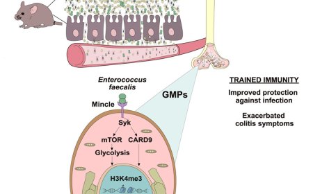 How the gut modulates the development of inflammatory conditions