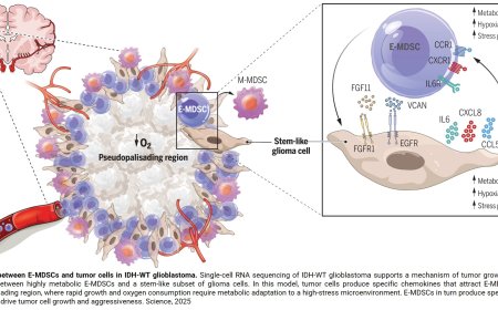 Co-located myeloid and tumor stem cells drive aggressive brain tumors