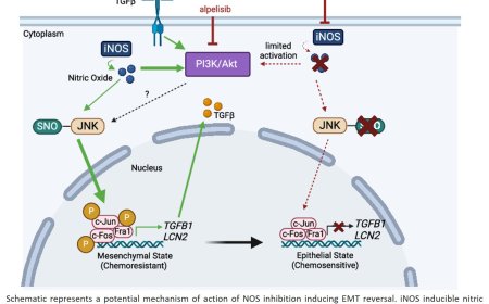 Combined inhibition of iNOS and PI3K to treat metaplastic breast cancer