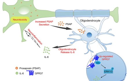Oligodendrocytes drive neuroinflammation and neurodegeneration in Parkinson’s disease