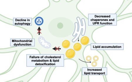 Mechanisms of astrocyte aging in reactivity and disease