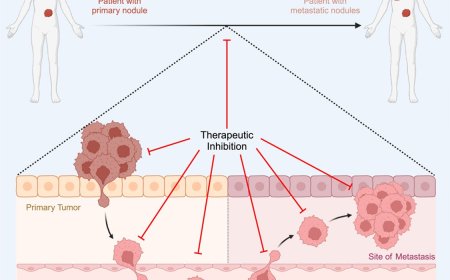Targeting metastatic cascade