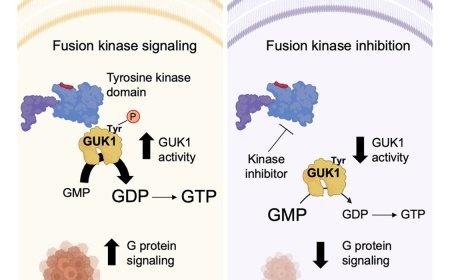 GUK1 boosts lung cancer metabolism to fuel growth