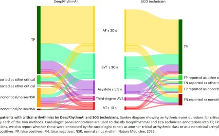 AI is better than humans at analyzing long-term ECG recordings