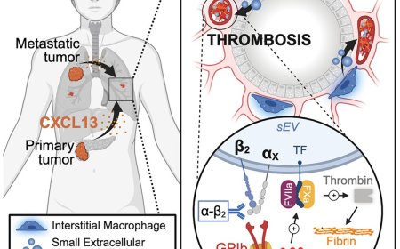 Blood clot formation from cancer in the lungs