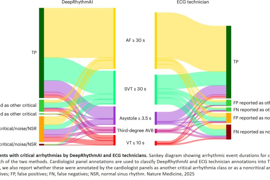 Ai Is Better Than Humans At Analyzing Long Term Ecg Recordings