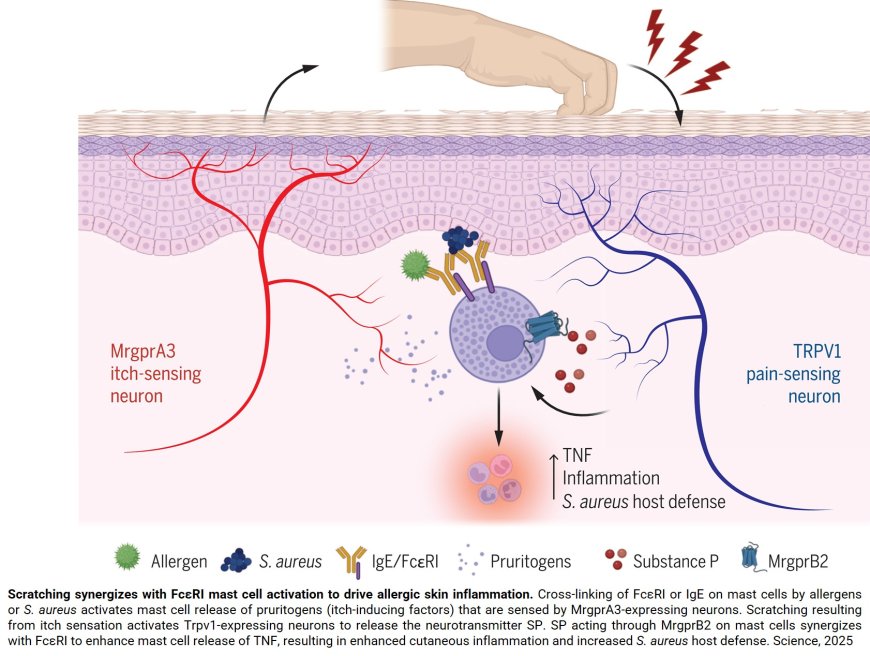 How scratching promotes allergic inflammation