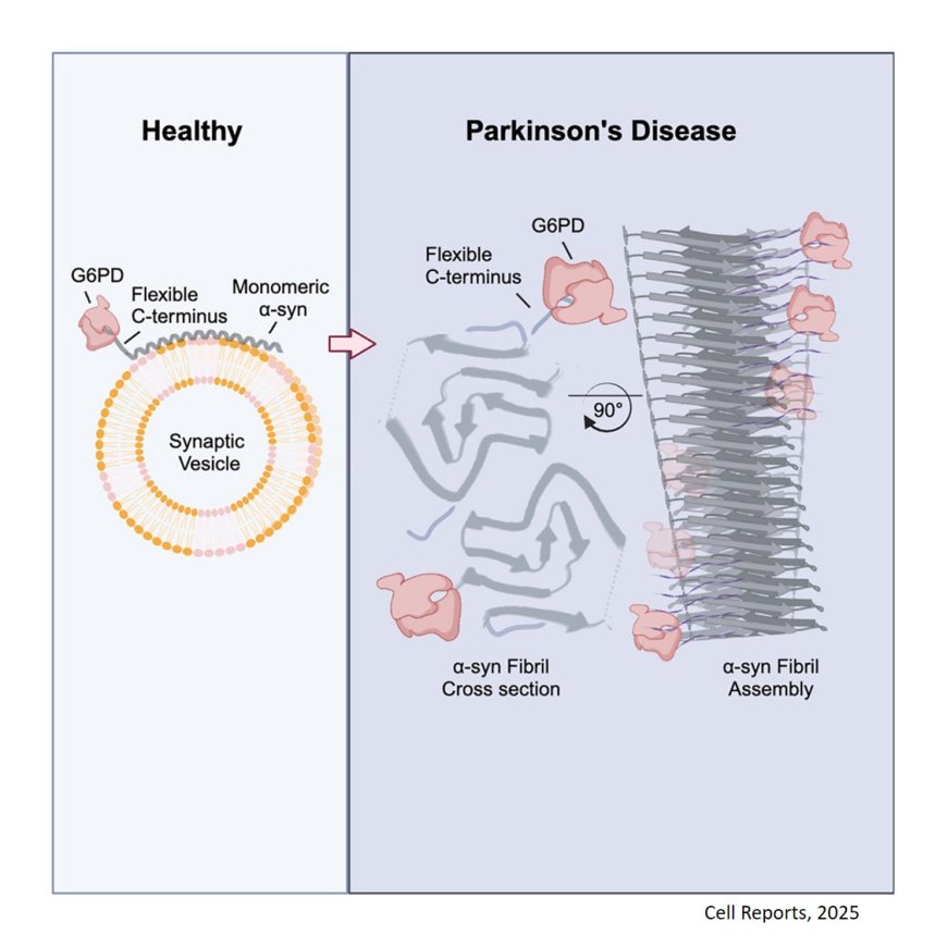 G6PD deficiency triggers dopamine loss and the initiation of Parkinson’s disease pathogenesis