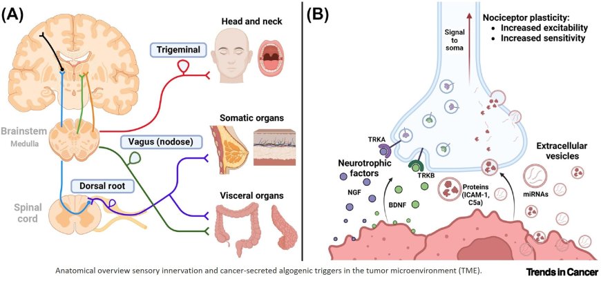 Sensory neurotransmission and pain in solid tumor progression