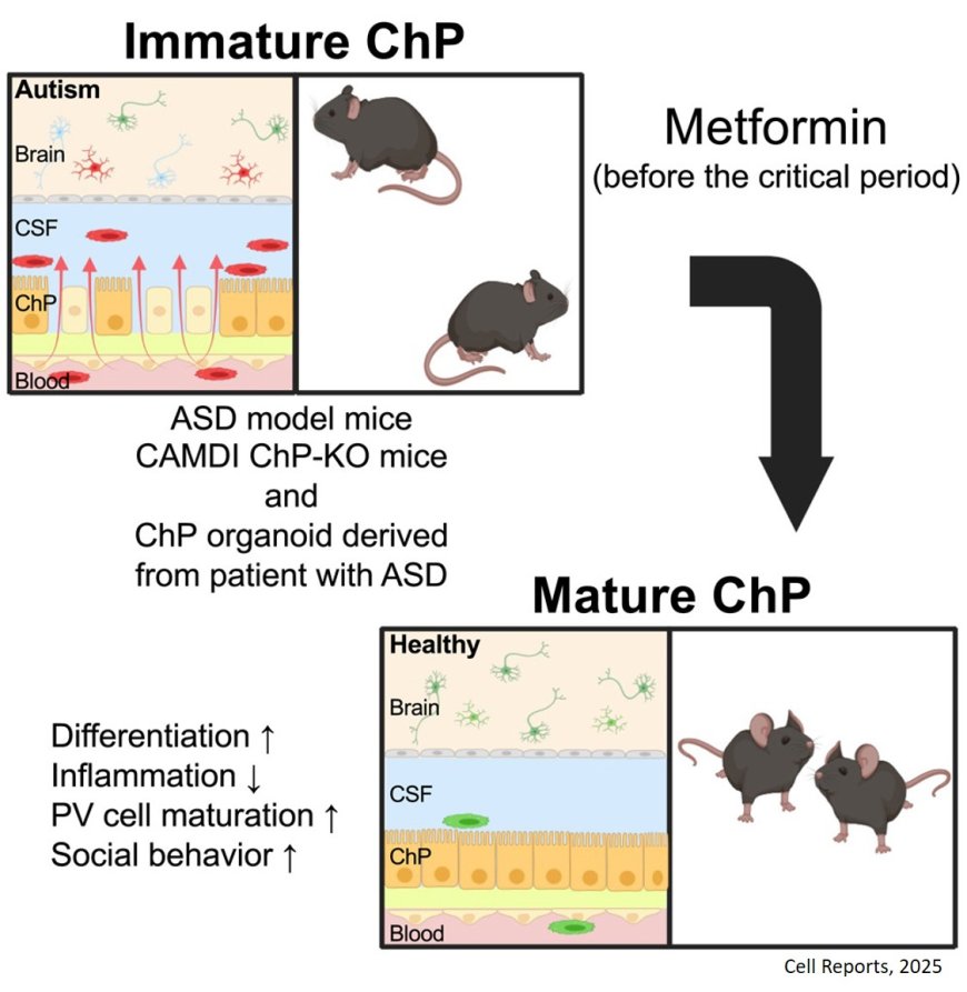 Immature choroid plexus in autism spectrum disorder