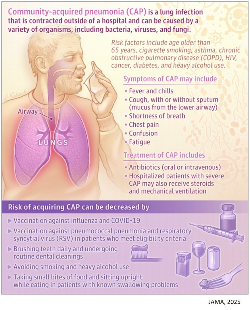 What Is Community-Acquired Pneumonia?