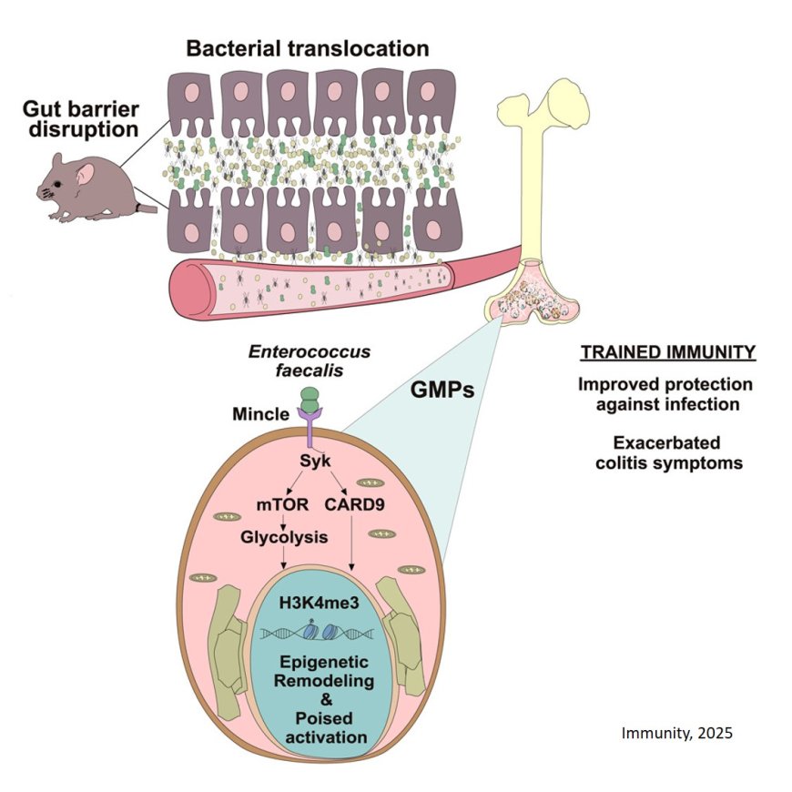 How the gut modulates the development of inflammatory conditions