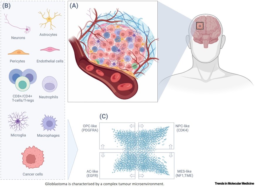 Spatial biology – unravelling complexity within the glioblastoma microenvironment