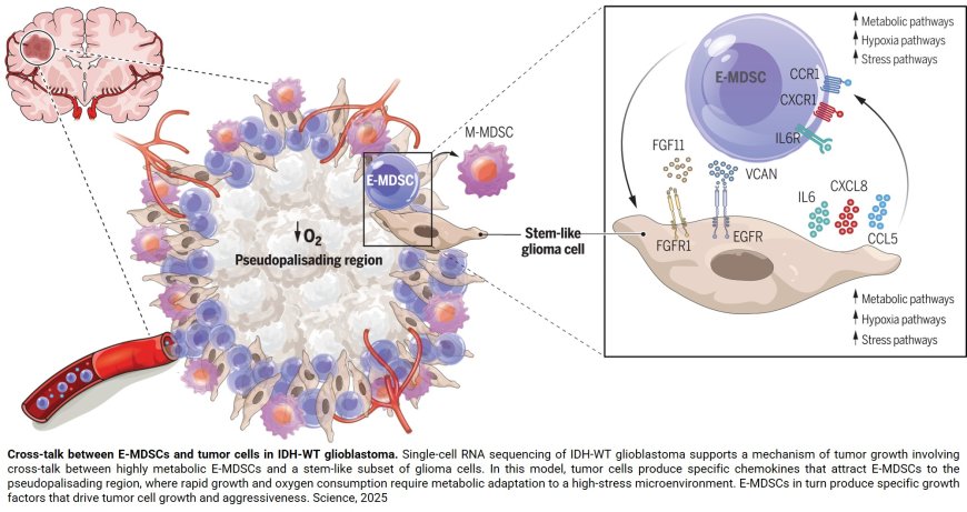 Co-located myeloid and tumor stem cells drive aggressive brain tumors