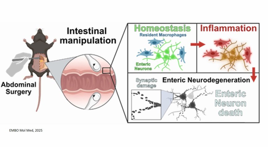 Macrophage-induced enteric neurodegeneration