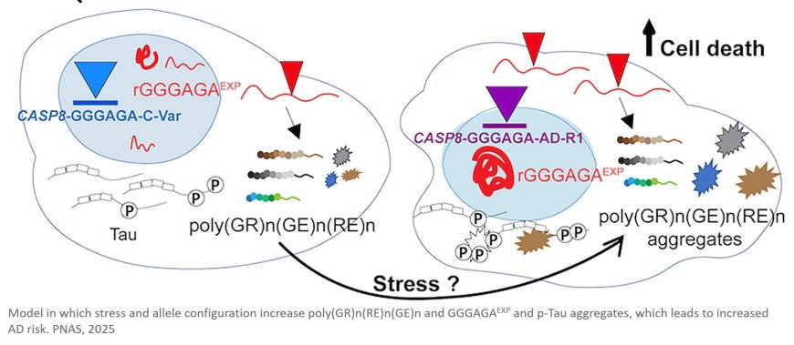 New genetic mutation linked to Alzheimer’s risk