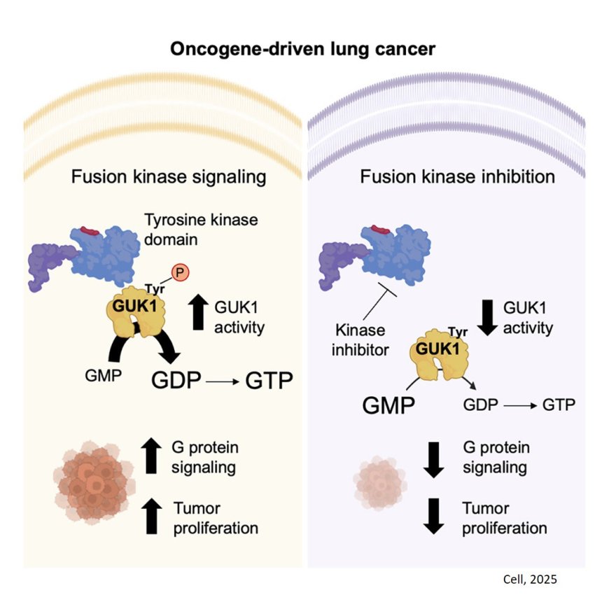 GUK1 boosts lung cancer metabolism to fuel growth