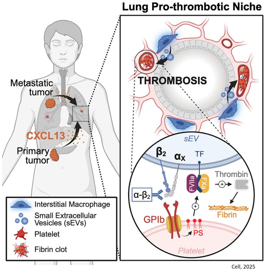 Blood clot formation from cancer in the lungs