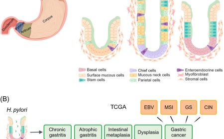Gastric pathophysiology in gastric cancer