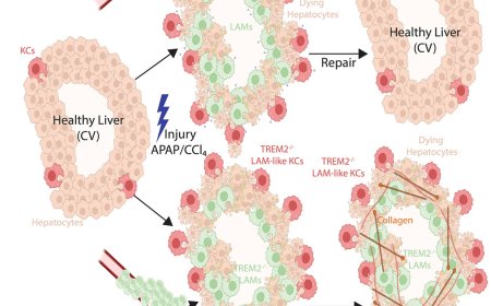 Distinct hepatic macrophages are required for tissue repair!