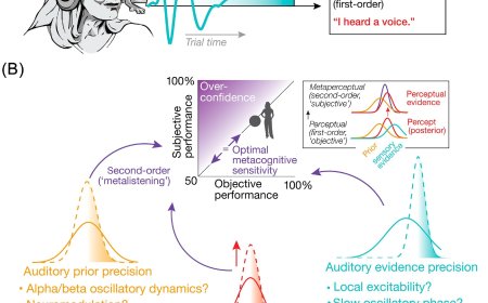 Metacognition in the listening brain