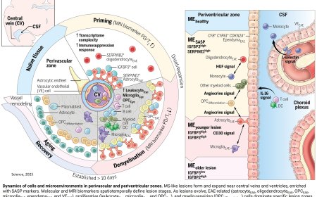 New 4D Brain Map reveals potential early warning signs of multiple sclerosis