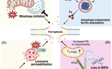 Autophagy-dependent versus autophagy-independent ferroptosis