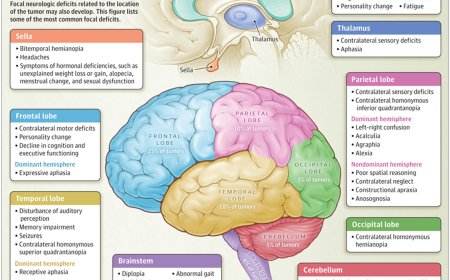 Glioblastoma etiology