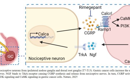 Nociceptive neurons promote gastric tumor progression