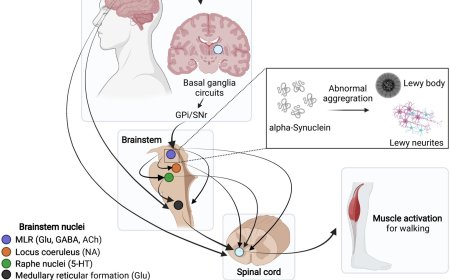 Pathobiological basis of gait dysfunction in Parkinson’s disease