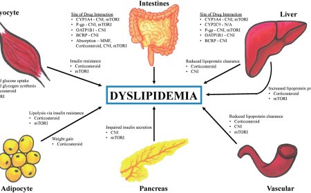 Dyslipidemia