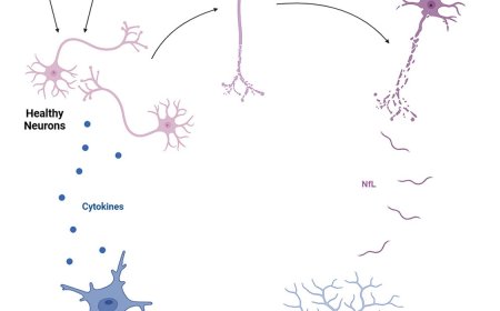 Neuroinflammation from secreted neurofilament light chain