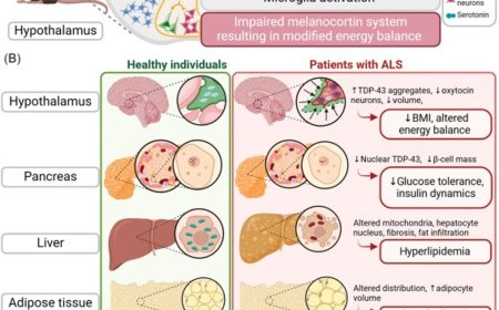 Metabolic vulnerabilities of amyotrophic lateral sclerosis