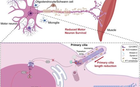 Cilia dysfunction in amyotrophic lateral sclerosis 