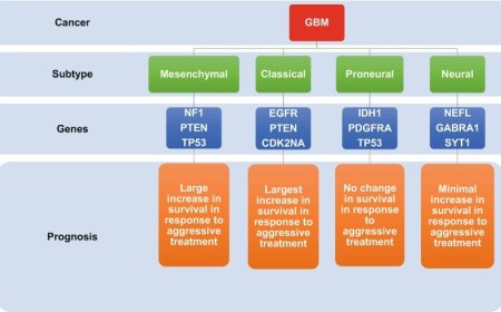 Glioblastoma prognosis