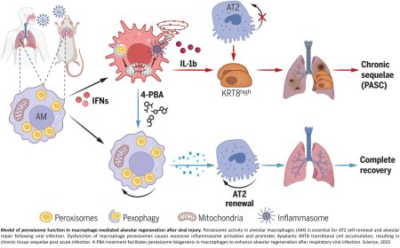 Regeneration of macrophage peroxisomes limit SARS-CoV-2 tissue inflammation