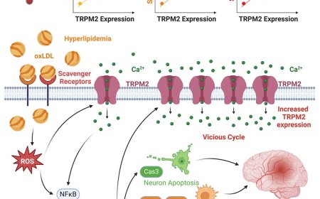 How hyperlipidemia may lead to stroke?